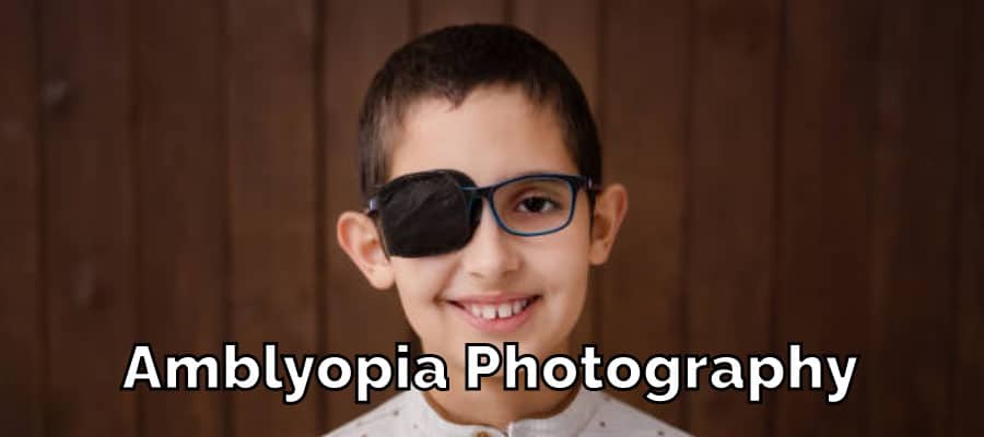 amblyopia-photography